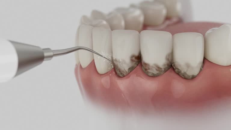 Reliable Root Canal Treatment contractor in Howard County County, AR by Dentist Open Now